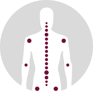 Icon für die Manuelle Behandlung mittels schematischer Darstellung von Gelenken am Oberkörper einer Person