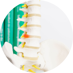 Foto eines Teils einer Wirbeläule vor medizinischen Fachbüchern